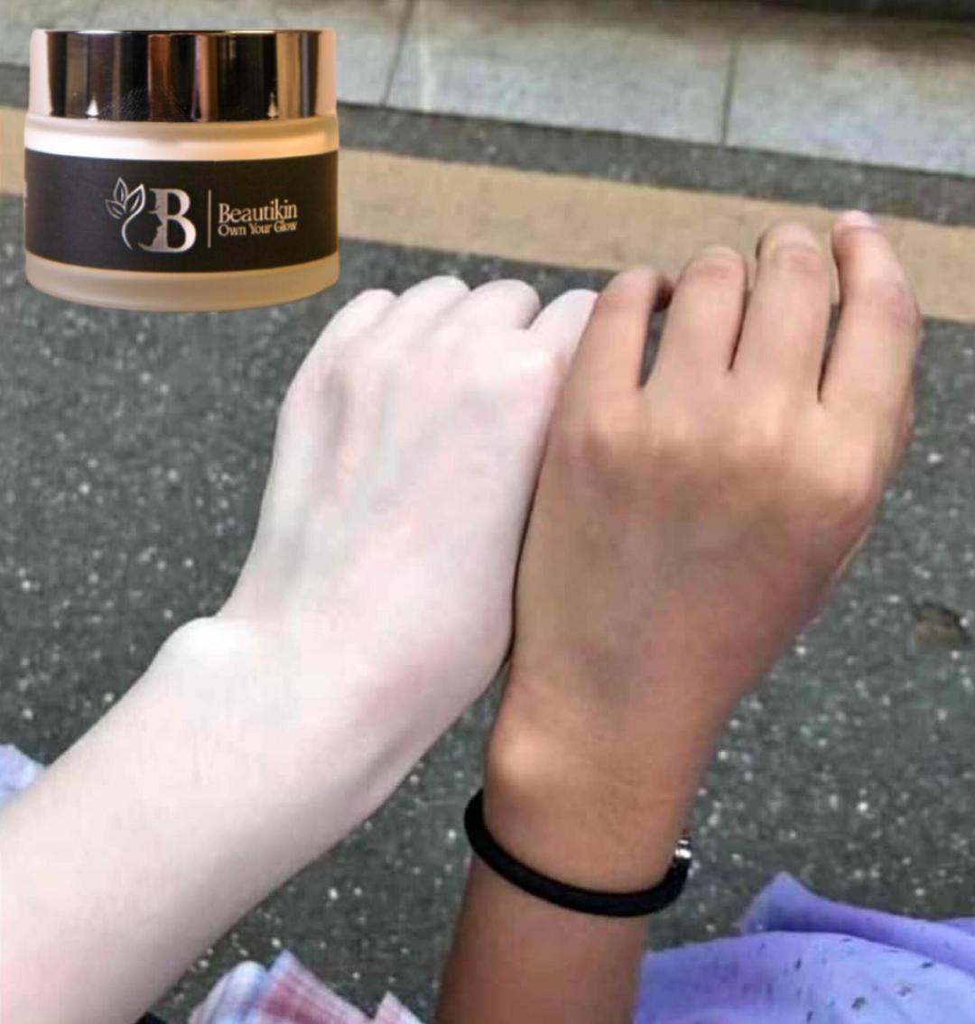 Whitening Cream for Radiant Glowing Skin