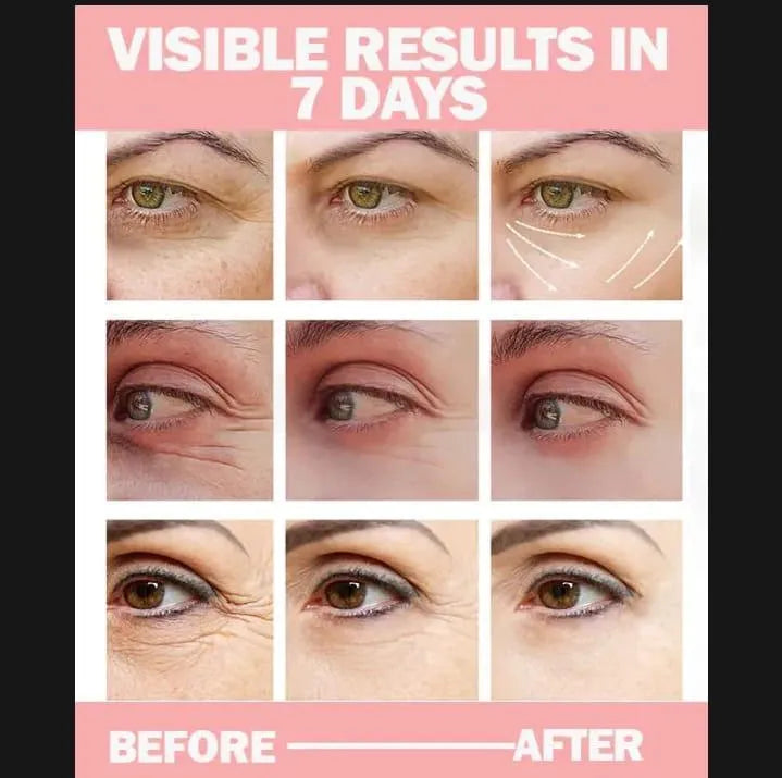 Fort Anti Dark Circle Eye Gel 30%